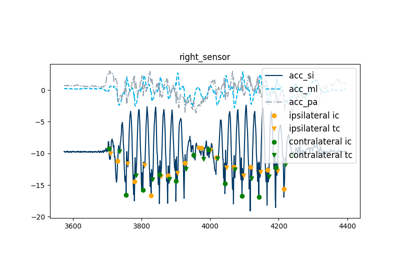 Gait Analysis Pipeline for Signia Hearing Aid Data